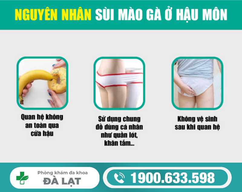 Hình ảnh minh họa